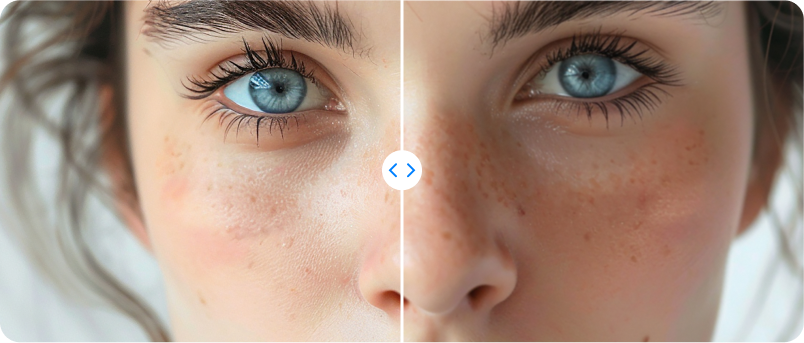 Contrast control image